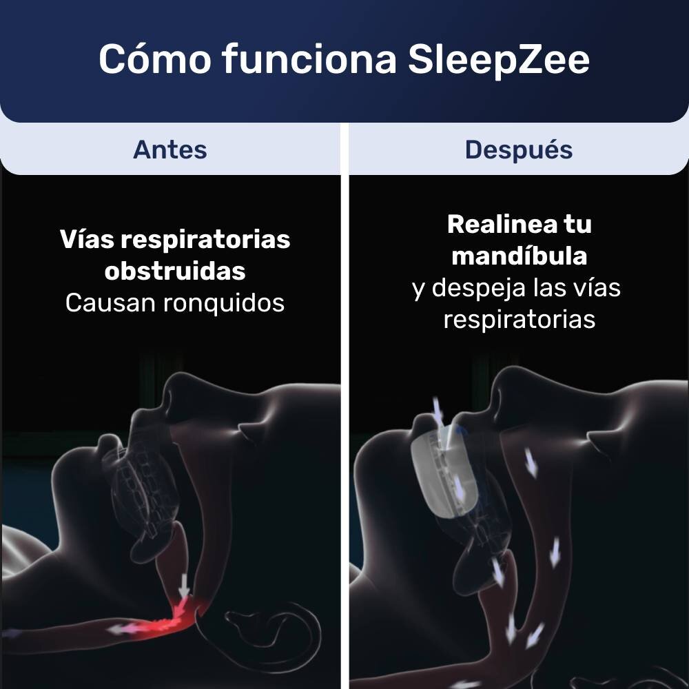 SleepZee image