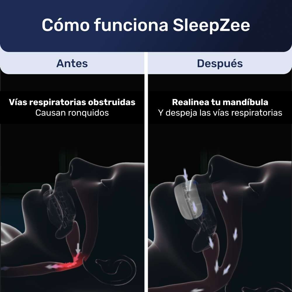 SleepZee image