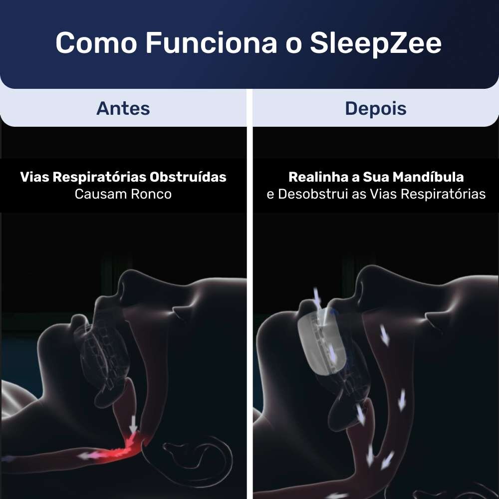SleepZee image